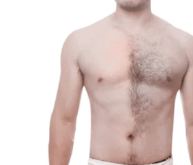 Best Hair Removal Cream