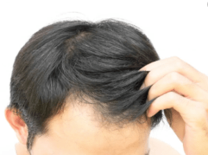 best oil for hair growth in India